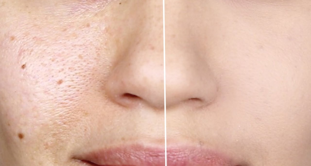 How to make Pores Disappear with Only One Ingredient Naturally