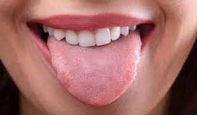 What Your Tongue Indicates About Your Health What Your Tongue Indicates About Your Health